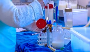 testul laptelui matern